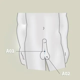 Hodensack
