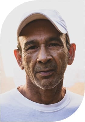 Spermatozele testis ist als eine kleine Nebenhoden-Retentionszyste im Hodensack zu spüren. Eine Abtragung der Spermatozele ist selten indiziert. Mehr erfahren!